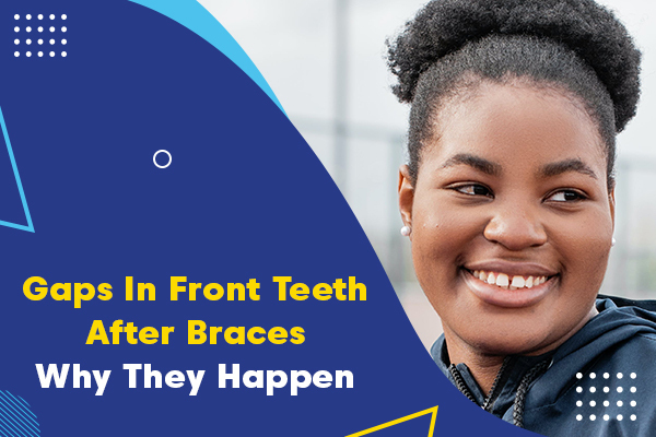 gap in front teeth after braces