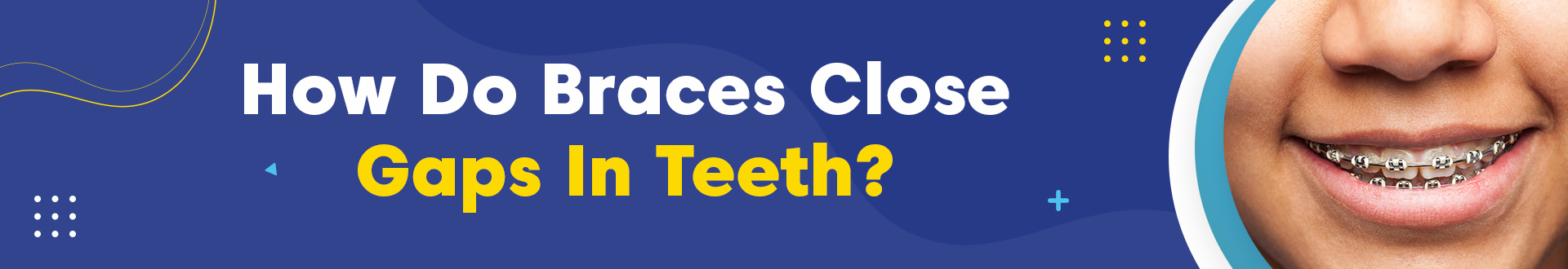 how to close gaps in teeth