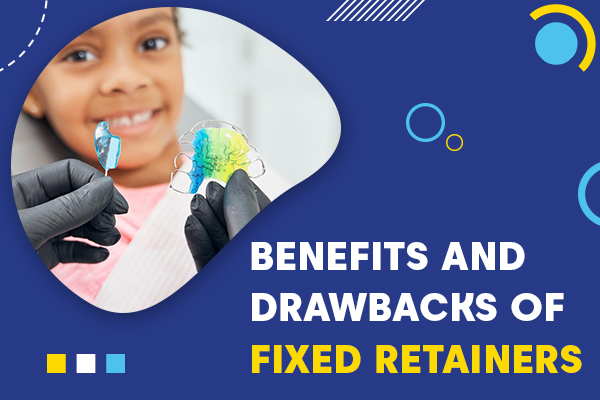 Benefits Of Fixed Retainers