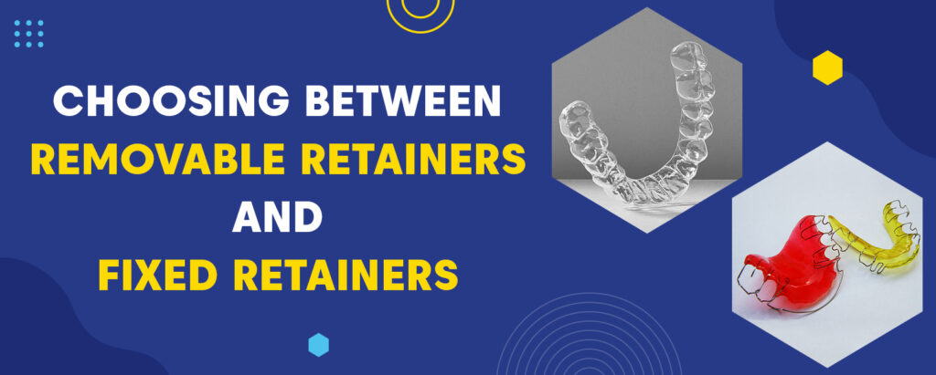 fixed vs removable retainer