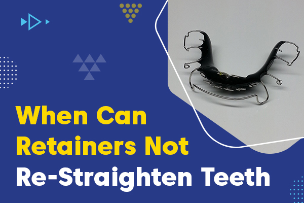 can retainers realign teeth