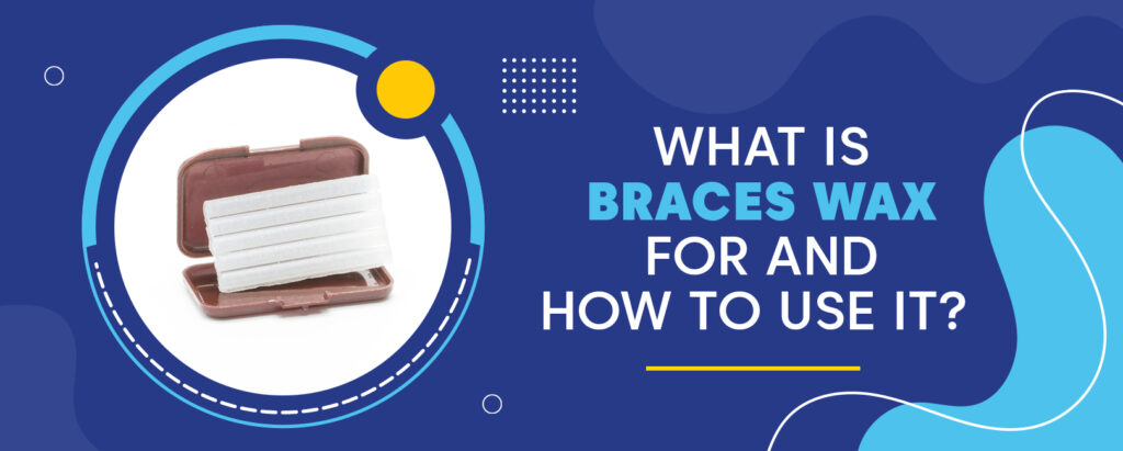 What Is Braces Wax For and How to Use It