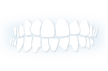 Orthodontist for Crossbite treatment in Kedzie, Chicago