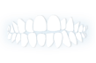 Orthodontist for Open Bite treatment in Kedzie, Chicago