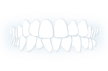 Orthodontist for Crowding treatment in Kedzie, Chicago