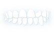 Orthodontist for Under bite treatment in Bucktown, Chicago
