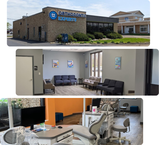 Orthodontic Experts Merrilville Clinic – Your Trusted Destination for Braces and Clear Aligner Treatments