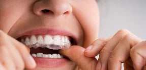 Clear Aligners