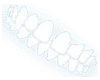 Gapped Teeth