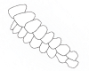 Overjet