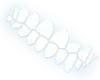 Underbite