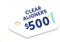  $500 Down on Clear Aligners