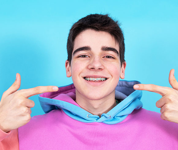 Classic braces color 