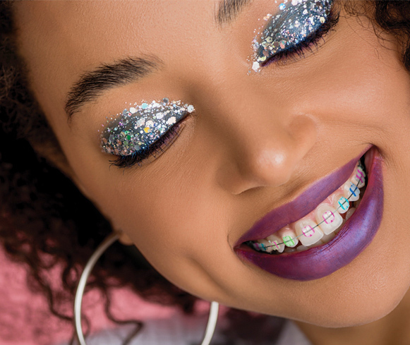 Trendy braces colors with creative combinations