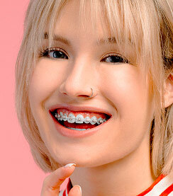 Cute pink braces color band