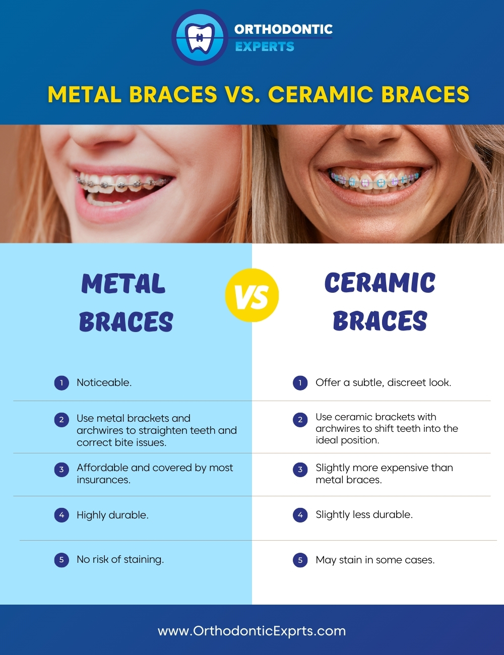 Metal Braces vs Ceramic Braces