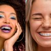 Metal vs Ceramic braces