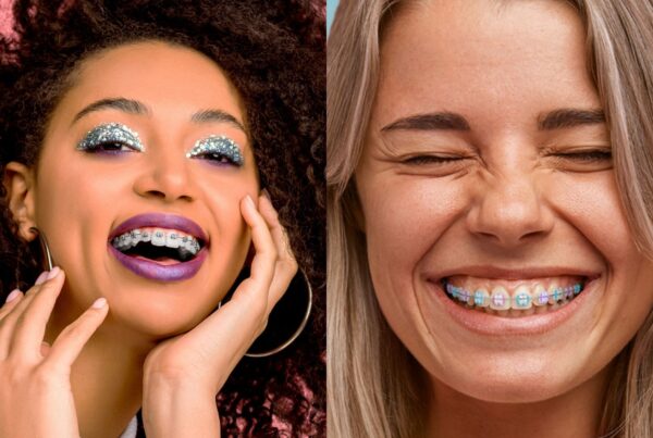Metal vs Ceramic braces