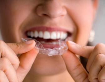 Clear Aligners for adults and professionals Near Gold Coast