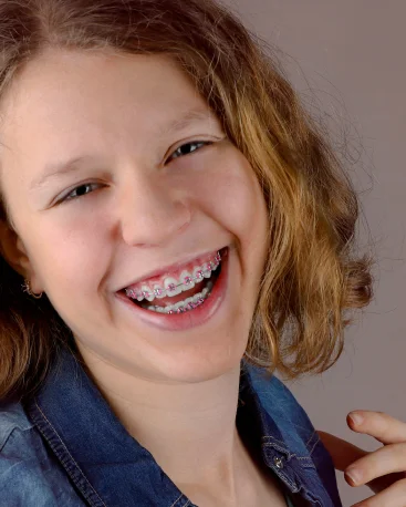 A Girl Is Smiling and Wearing Colorful Braces.