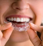 Wearing 3M Clear Aligners