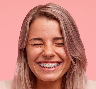 Ceramic braces (tooth-colored fixed braces)