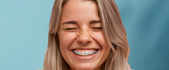 Cost of Ceramic Braces