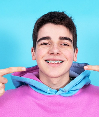 Choose braces colors by style and personality