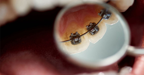 what-to-expect-during-treatment