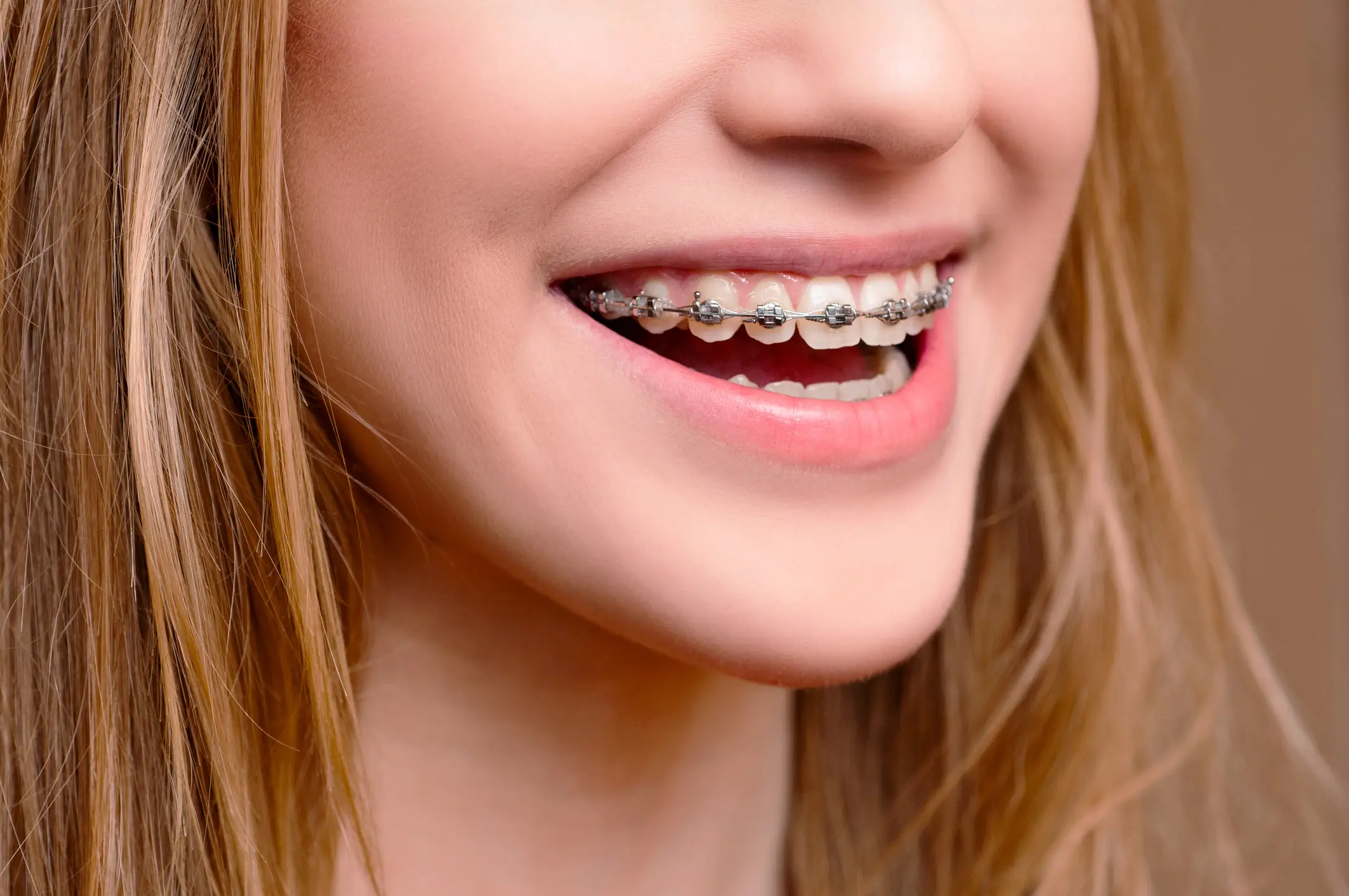 Adult deciding to wear braces