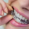 How Long Do Retainers Last