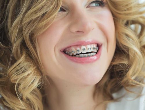 front-ortho front-ortho
